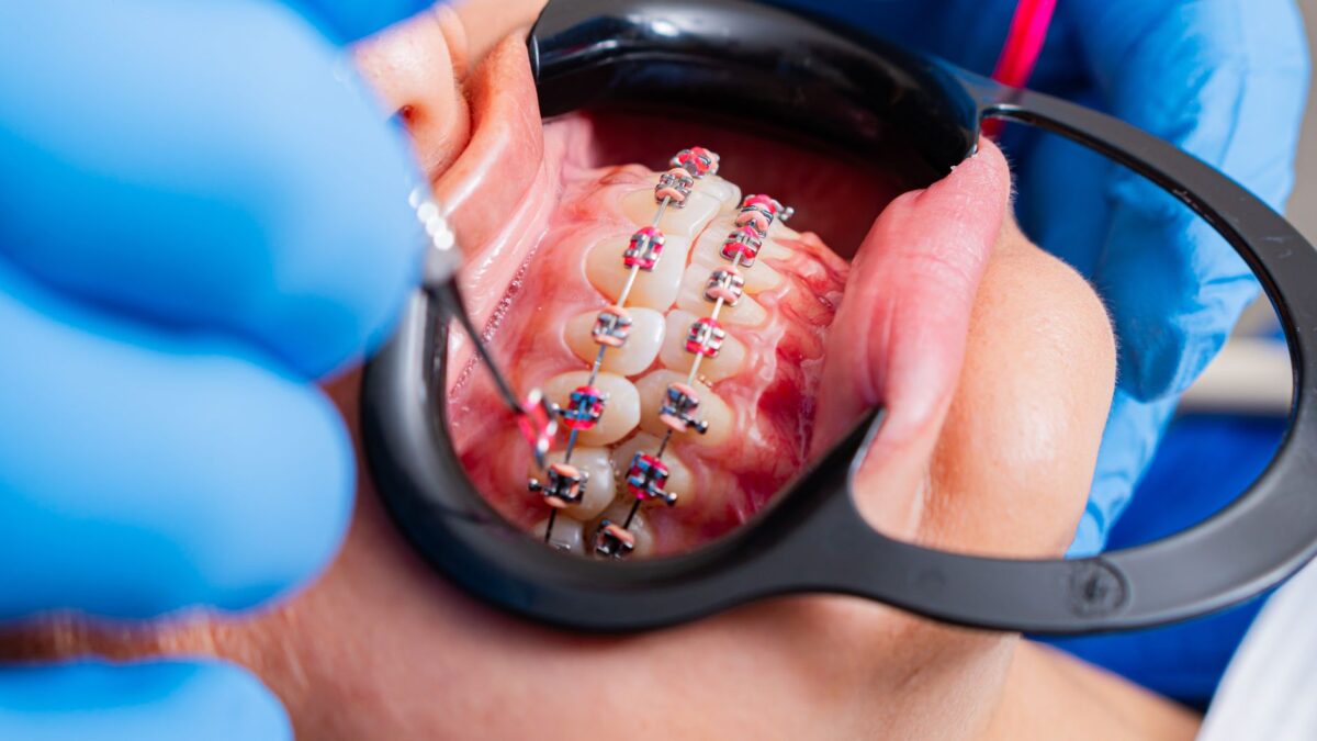 Exploring Advancements in Orthodontic Technology