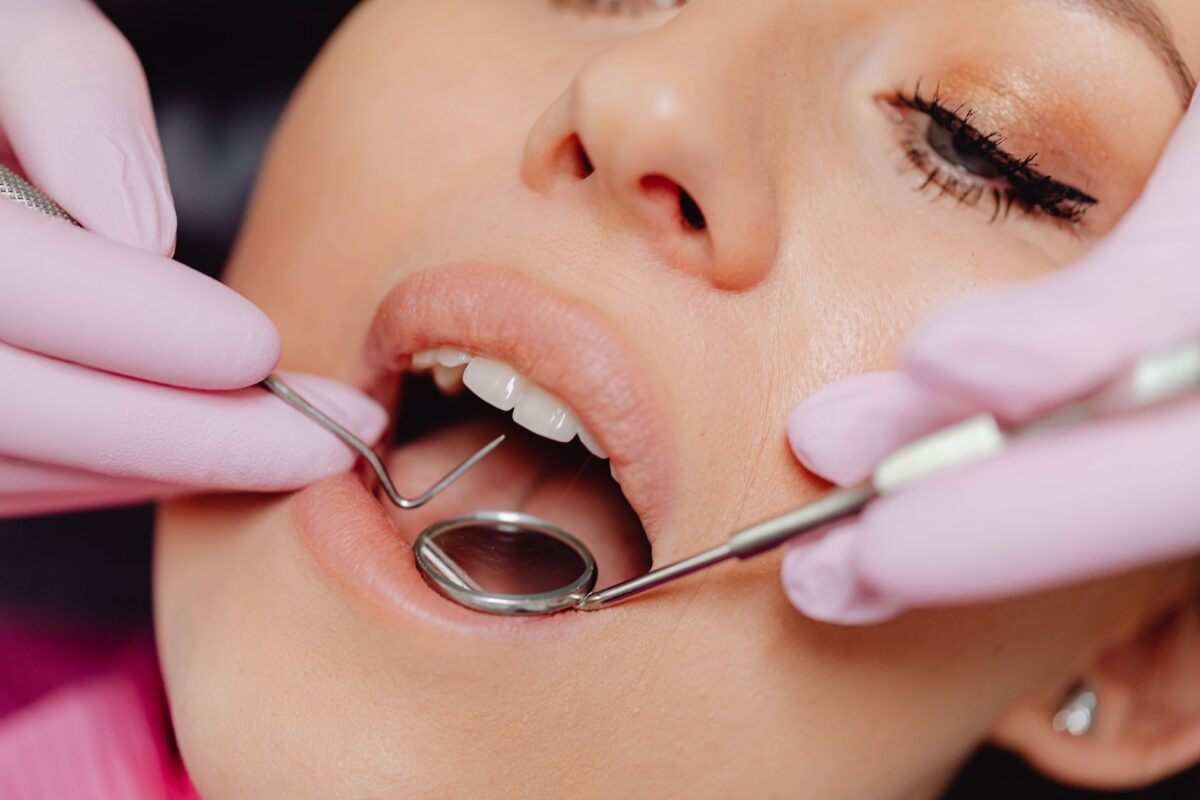 How to Prevent Cavities: Simple Tips for Better Oral Health