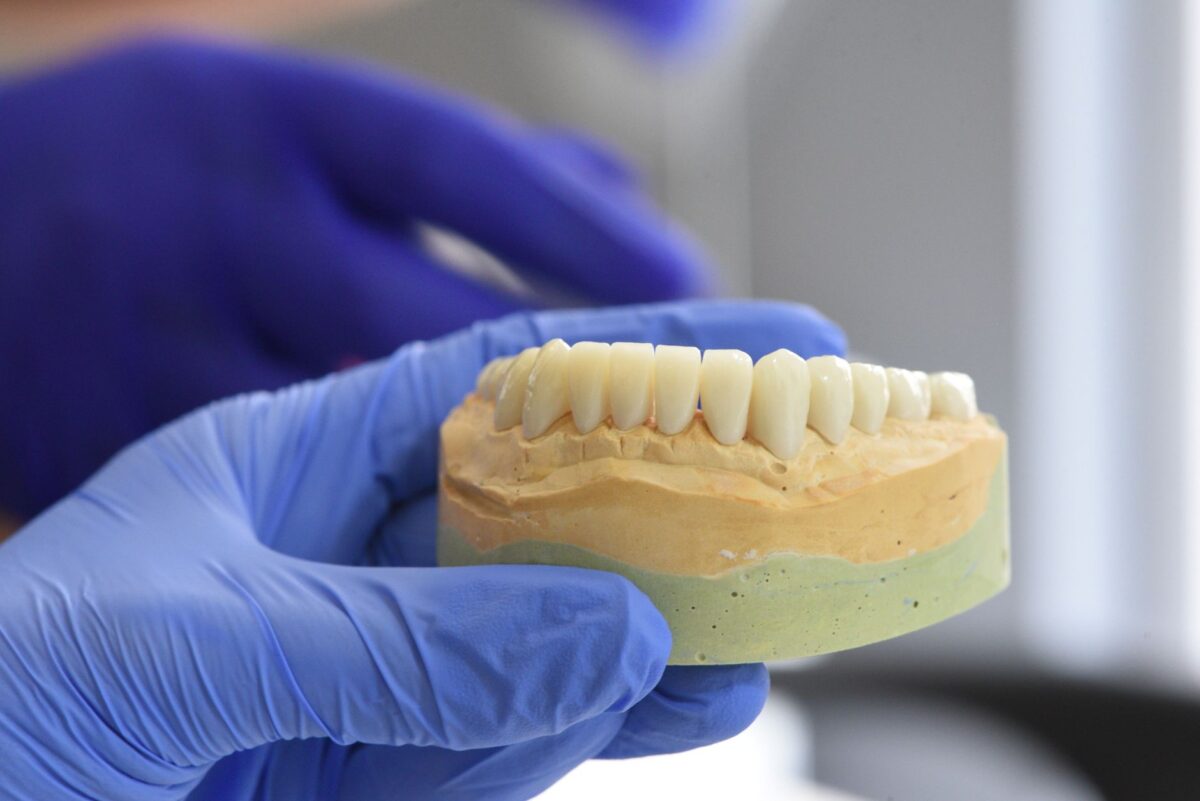 Understanding Dental Implants: How Do They Work?