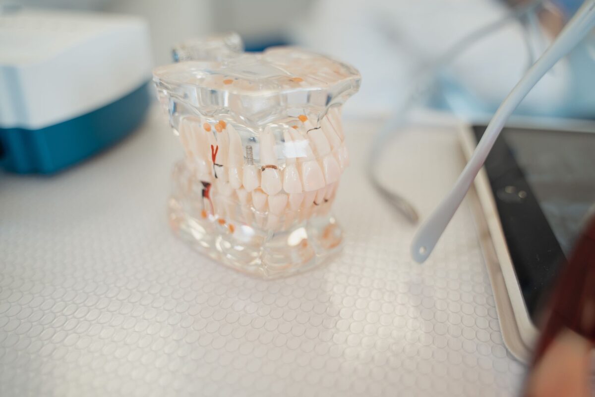 Understanding the Dental Implant Procedure: Step by Step