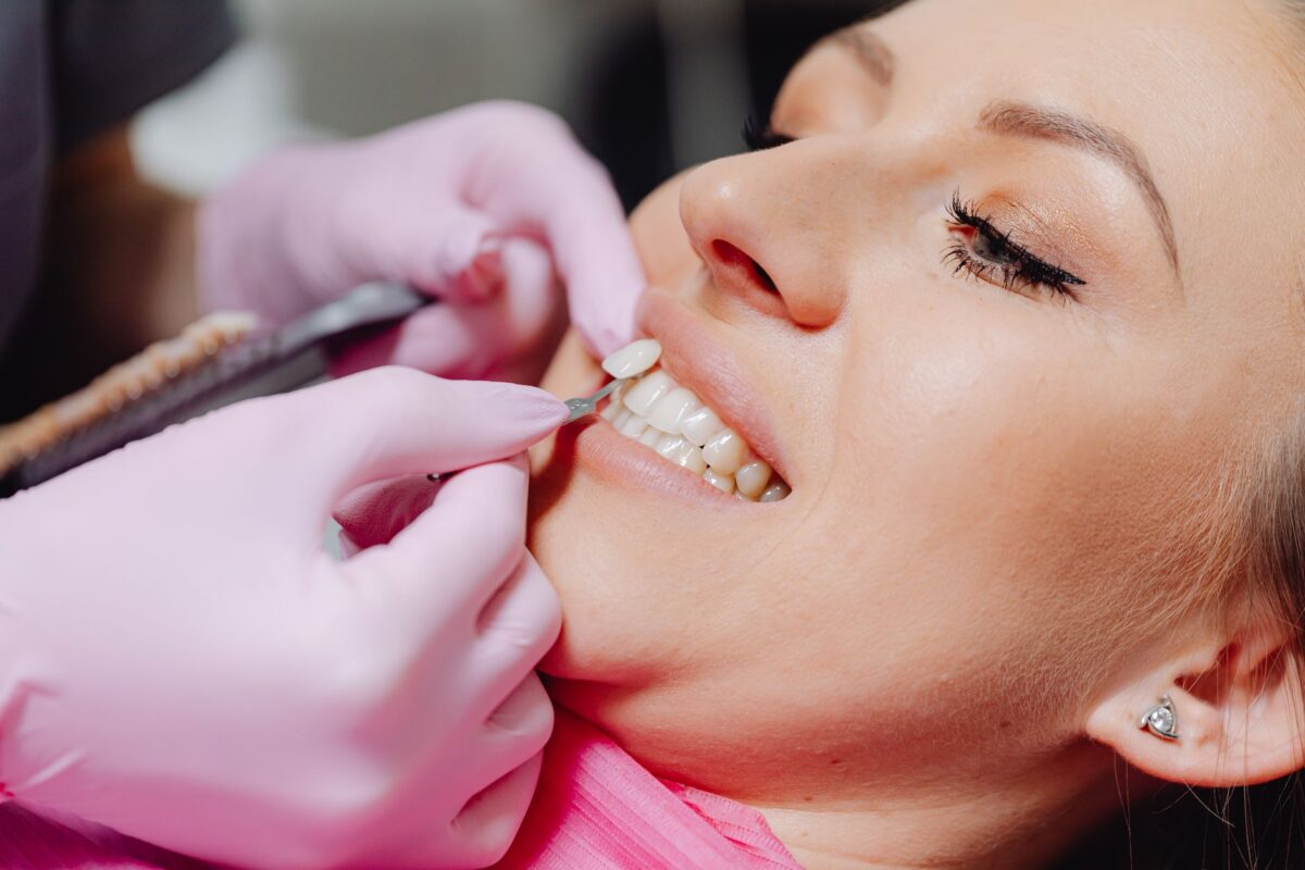 Getting Ready for Veneers: Preparation Tips for a Perfect Smile