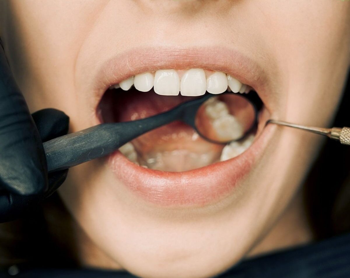 Recognizing the Signs of Gum Disease Early for Better Management