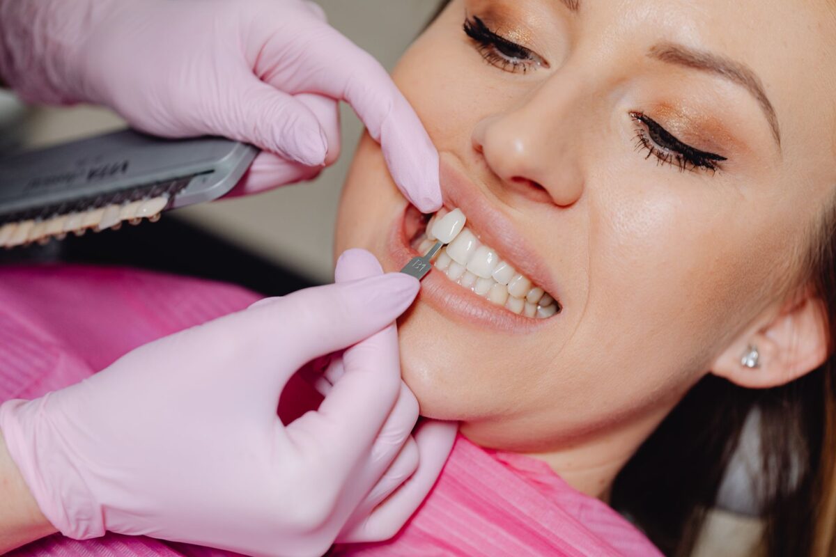 Discover the Art of Smiles: What Is Porcelain Veneer?