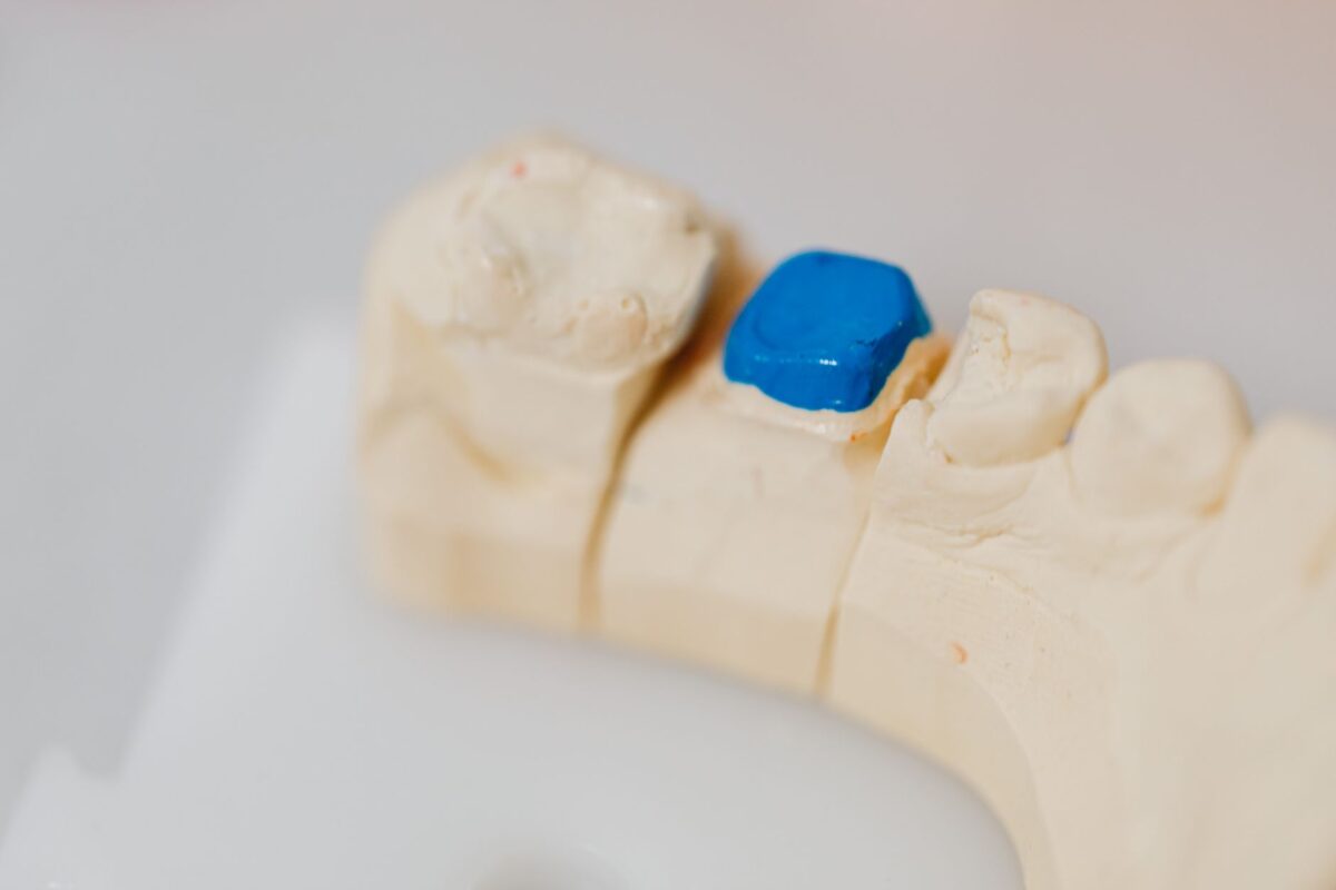 Exploring Different Types of Dental Fillings: Which Is Right for You?