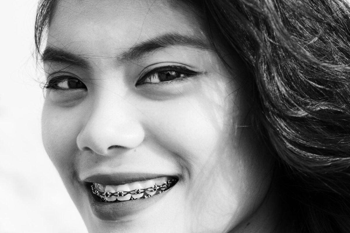 Unlock Your Smile: The Benefits of Orthodontic Treatment for Adults