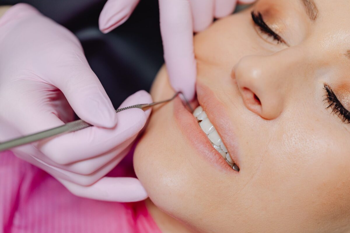 How Long Does Dental Bonding Last (and What Makes It Wear Out Faster)?