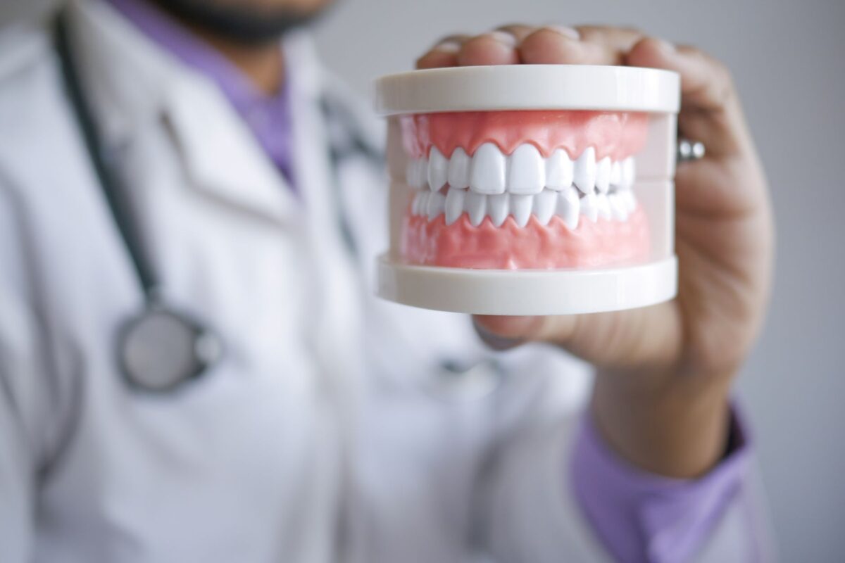 How Long Does Dental Bonding Last (and What Makes It Wear Out Faster)?