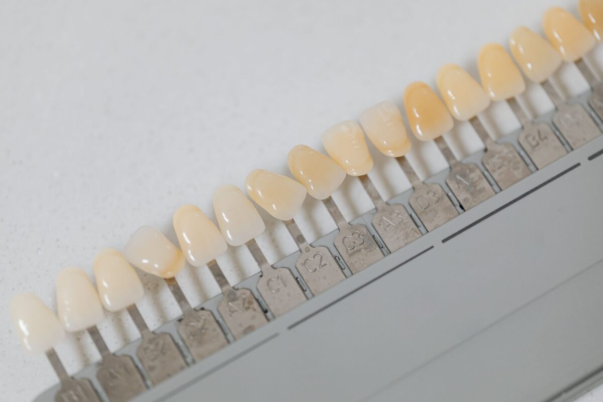 Cavity vs. Stain: How to Tell the Difference