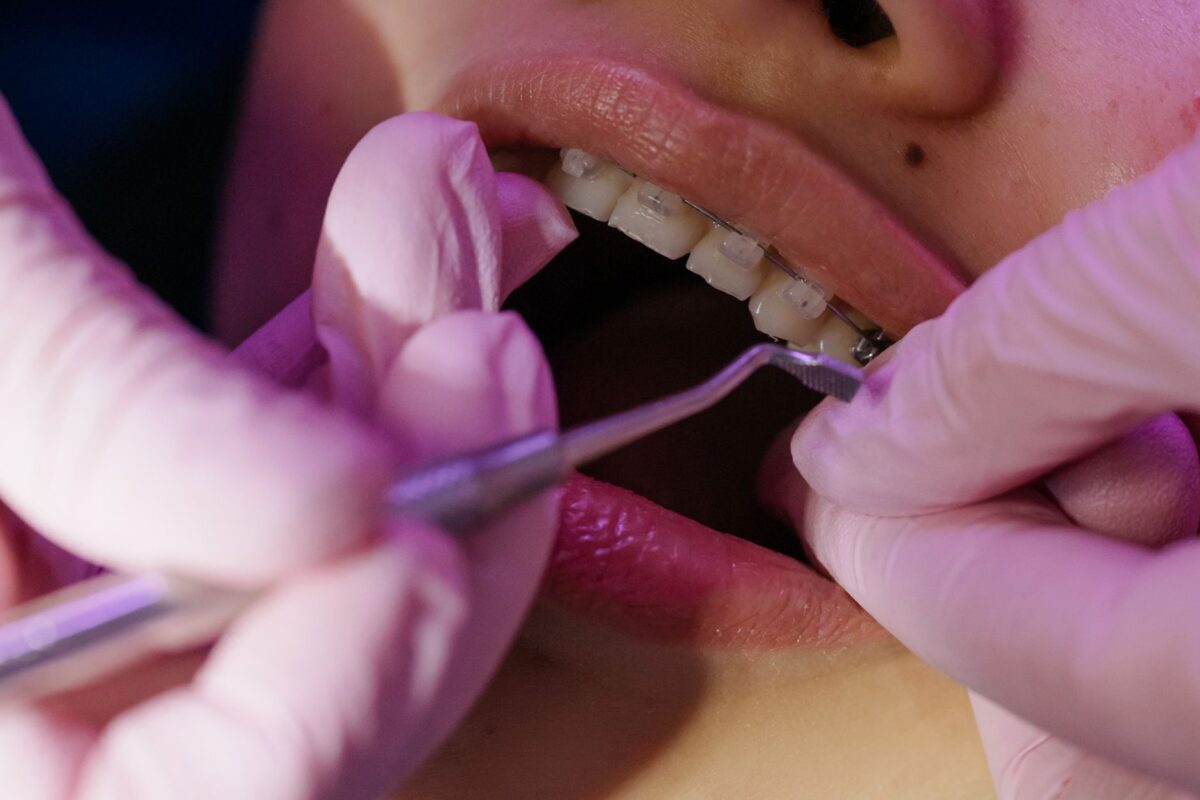 Can You Get Braces If You Have Gum Disease?